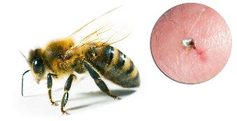 In der zusammensetzung der Hondrostrong enthält bienengift verbessert die stoffwechselprozesse im gewebe