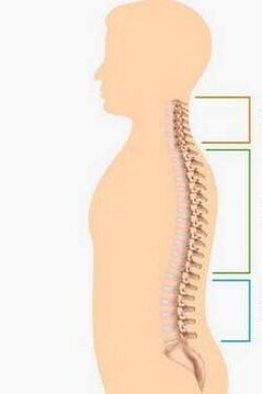 Niederlage durch Osteochondrose verschiedener Teile der Wirbelsäule